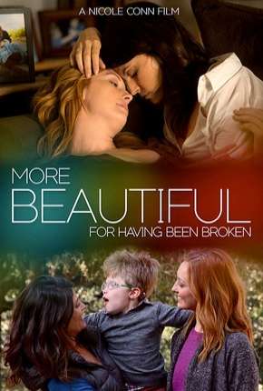 More Beautiful for Having Been Broken - Legendado Torrent Download Mais Baixado